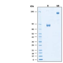 R D Systems Recombinant Human IL-1 RI Fc Chimera Protein 100 &mu;g | Buy Online | R&amp;D Systems&trade; | Fisher Scientific