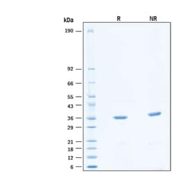 R&D Systems&trade;&nbsp;Recombinant Human c-Abl His-tag Protein
