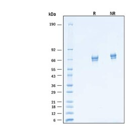 R D Systems Recombinant Cynomolgus Monkey CD39/ENTPD1 His Protein 20 &mu;g | Buy Online | R&amp;D Systems&trade; | Fisher Scientific