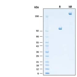 R D Systems Recombinant Mouse Semaphorin 4A mFc Chimera Protein 50 &mu;g | Buy Online | R&amp;D Systems&trade; | Fisher Scientific