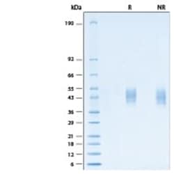 R&D Systems&trade;&nbsp;Recombinant Human NETO1 His-tag Protein