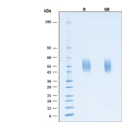 R&D Systems&trade;&nbsp;Recombinant SARS-CoV-2 B.1.1.529 S1 NTD His-tag Protein