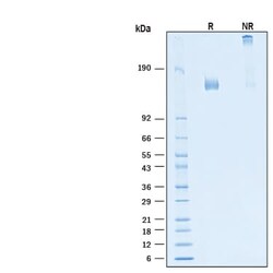 R&D Systems&trade;&nbsp;Recombinant SARS-CoV-2 B.1.640.2 S (GCN4-IZ) His Protein