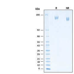 R&D Systems&trade;&nbsp;Recombinant SARS-CoV-2 P.2 Spike (GCN4-IZ) His Protein