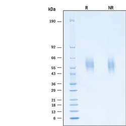 R&D Systems&trade;&nbsp;Recombinant SARS-CoV-2 Spike S1 NTD His-tag Protein