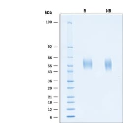 R&D Systems&trade;&nbsp;Recombinant SARS-CoV-2 B.1.351 S1 NTD His-tag Protein