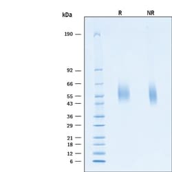 R D Systems Recombinant SARS-CoV-2 B.1.1.7 Spike S1 NTD His Protein 100 &mu;g | Buy Online | R&amp;D Systems&trade; | Fisher Scientific