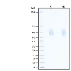 R&D Systems&trade;&nbsp;Recombinant Human FGFR2 alpha (IIIc) His-tag Protein