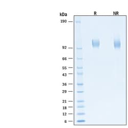 R&D Systems&trade;&nbsp;Recombinant SARS-CoV-2 B.1.617.2 S1 His-tag Protein