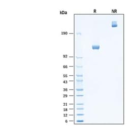 R D Systems Recombinant Human DPPIV/CD26 Fc Chimera Protein 20 &mu;g | Buy Online | R&amp;D Systems&trade; | Fisher Scientific
