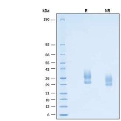 R D Systems Recombinant Cyno Lymphotoxin beta R/TNFRSF3 His Protein 100 &mu;g | Buy Online | R&amp;D Systems&trade; | Fisher Scientific