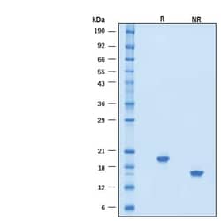 R D Systems Recombinant Human IFN-alpha 21/IFNA21 Protein 10 &mu;g | Buy Online | R&amp;D Systems&trade; | Fisher Scientific