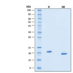 R D Systems Recombinant Human IFN-alpha 6/IFNA6 Protein 50 &mu;g | Buy Online | R&amp;D Systems&trade; | Fisher Scientific