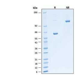 R D Systems Recombinant Cynomolgus/Rhesus Hepassocin/FGL1 Fc Protein 50 &mu;g | Buy Online | R&amp;D Systems&trade; | Fisher Scientific