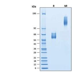 R D Systems Recombinant Human HVEM/TNFRSF14 Fc Chimera Protein 100 &mu;g | Buy Online | R&amp;D Systems&trade; | Fisher Scientific