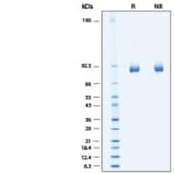 R D Systems Recombinant Human alpha-L-Iduronidase/IDUA His Protein 20 &mu;g | Buy Online | R&amp;D Systems&trade; | Fisher Scientific