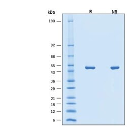 R&D Systems&trade;&nbsp;Recombinant SARS-CoV-2 BA.2 Nucleocapsid His-tag Protein