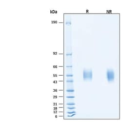 R&D Systems&trade;&nbsp;Recombinant SARS-CoV-2 BA.4/BA.5 S1 NTD His-tag Protein