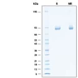 R D Systems Recombinant Human alpha-L-Iduronidase/IDUA His Protein 20 &mu;g | Buy Online | R&amp;D Systems&trade; | Fisher Scientific