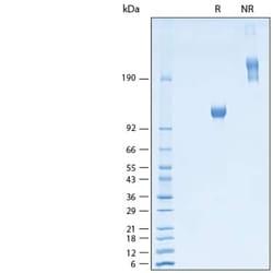 R&D Systems&trade;&nbsp;Recombinant Rat Osteoactivin/GPNMB Fc Chimera Protein