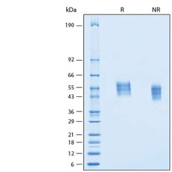 R D Systems Recombinant Human IL1RAPL2 His-tag Protein 100 &mu;g | Buy Online | R&amp;D Systems&trade; | Fisher Scientific