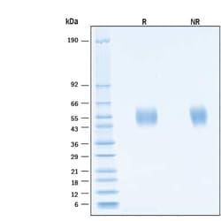 R&D Systems&trade;&nbsp;Recombinant SARS-CoV-2 XD Spike S1 NTD His-tag Protein