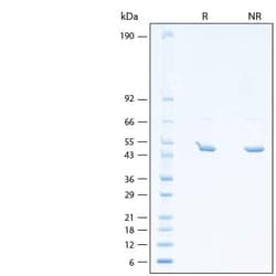 R&D Systems&trade;&nbsp;Recombinant SARS-CoV-2 B.1.2 (+D399N) N (1-419) Protein