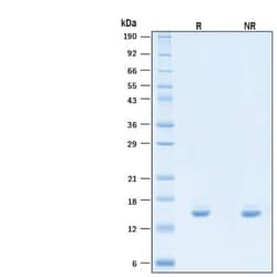 R D Systems Recombinant Human IL-2 (C145S, HEK293-expressed) Protein 10 &mu;g | Buy Online | R&amp;D Systems&trade; | Fisher Scientific
