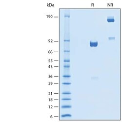 R D Systems Recombinant Mouse IL1RAPL2 Fc Chimera Protein 50 &mu;g | Buy Online | R&amp;D Systems&trade; | Fisher Scientific