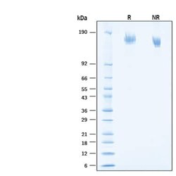R D Systems Recombinant SARS-CoV-2 BA.4/BA.5 S GCN4-IZ His Protein 100 &mu;g | Buy Online | R&amp;D Systems&trade; | Fisher Scientific