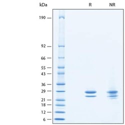 R D Systems Recombinant Human FGF-9 (HEK293-expressed) Protein 50 &mu;g | Buy Online | R&amp;D Systems&trade; | Fisher Scientific