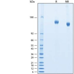 R D Systems Recombinant SARS-CoV-2 BA.2.75 S (GCN4-IZ) His Protein 100 &mu;g | Buy Online | R&amp;D Systems&trade; | Fisher Scientific