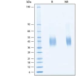 R&D Systems&trade;&nbsp;Recombinant Porcine alpha3GalT/GGTA1 His-tag Protein