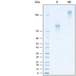 R D Systems Recombinant Human TIM-1/KIM-1/HAVCR (275 aa) Fc Protein 50 &mu;g | Buy Online | R&amp;D Systems&trade; | Fisher Scientific