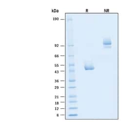 R D Systems Recombinant Monkeypox Virus A35R Fc Chimera Protein 100 &mu;g | Buy Online | R&amp;D Systems&trade; | Fisher Scientific
