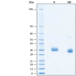 R D Systems Recombinant SARS-CoV-2 BA.4.6 Spike RBD His-tag Protein 100 &mu;g | Buy Online | R&amp;D Systems&trade; | Fisher Scientific