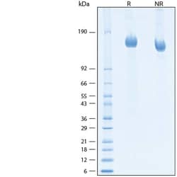 R D Systems Recombinant SARS-CoV-2 BA.4.6 Spike GCN4-IZ His Protein 100 &mu;g | Buy Online | R&amp;D Systems&trade; | Fisher Scientific