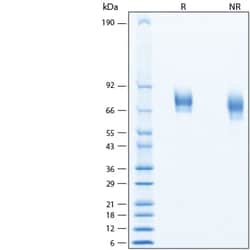 R&D Systems&trade;&nbsp;Recombinant Human IL-12 R beta 1 His-tag Protein