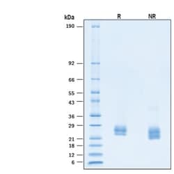 R D Systems Recombinant Human KGF/FGF-7 Protein 500 &mu;g | Buy Online | R&amp;D Systems&trade; | Fisher Scientific