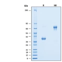 R D Systems Recombinant Human NRG1/HRG1-alpha EGF domain Fc Protein 500 &mu;g | Buy Online | R&amp;D Systems&trade; | Fisher Scientific