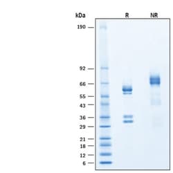R D Systems Recombinant Human HGF (NS0 Expressed) Protein 100 &mu;g | Buy Online | R&amp;D Systems&trade; | Fisher Scientific