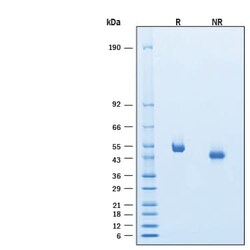R D Systems Recombinant Mouse IL-5 R alpha/CD125 His-tag Protein 25 &mu;g:Rekombinante
