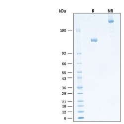R D Systems Recombinant Human MDGA1 Fc Chimera Protein, CF 50 &mu;g | Buy Online | R&amp;D Systems&trade; | Fisher Scientific