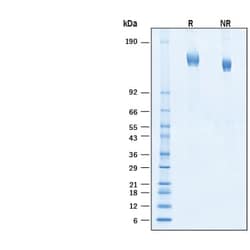 R D Systems Recombinant SARS-CoV-2 XBB.1.5 Spike GCN4-IZ His Protein, CF 100 &mu;g | Buy Online | R&amp;D Systems&trade; | Fisher Scientific