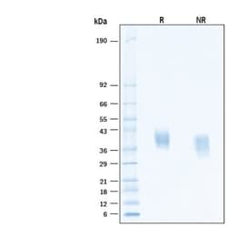 R D Systems Recombinant Human Dkk-1 Protein, CF 1 mg | Buy Online | R&amp;D Systems&trade; | Fisher Scientific