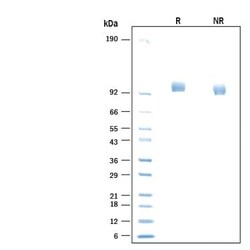 R D Systems Recombinant Mouse Lysosomal alpha-Glucosidase/GAA, CF 25 &mu;g | Buy Online | R&amp;D Systems&trade; | Fisher Scientific