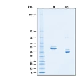 R D Systems Recombinant Human IL-12/IL-23 p40 Protein, CF 1 mg | Buy Online | R&amp;D Systems&trade; | Fisher Scientific