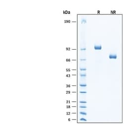 R D Systems Recombinant Cyno/Rhesus Lysyl Oxidase Homolog 2 Protein, CF 20 &mu;g | Buy Online | R&amp;D Systems&trade; | Fisher Scientific