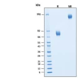 R D Systems Recombinant Human IL-10 R beta Fc Chimera Protein, CF 100 &mu;g | Buy Online | R&amp;D Systems&trade; | Fisher Scientific
