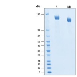 R D Systems Recombinant SARS-CoV-2 BA.2.86 Spike GCN4-IZ His Protein, CF 100 &mu;g | Buy Online | R&amp;D Systems&trade; | Fisher Scientific